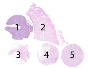 Material The slide to be stained for SMH comprised: Assessment Run 50 2017 SMH (Myosin, smooth muscle heavy chain) 1.Tonsil, 2. Esophagus, 3. Breast hyperplasia, 4.