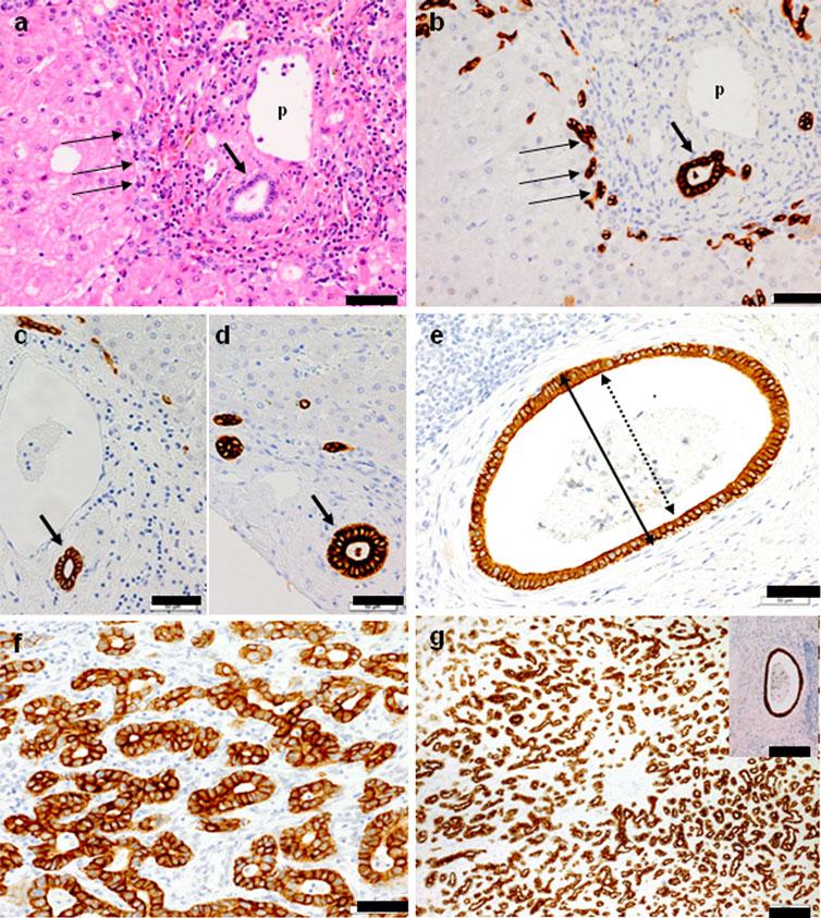 J Hepatobiliary Pancreat Sci (2012) 19:289 296 291 Fig. 1 Classification of various ducts. a HE stain, b g CK7 immunostain. Bar 50 lm (a f), bar 200 lm (g and inset).