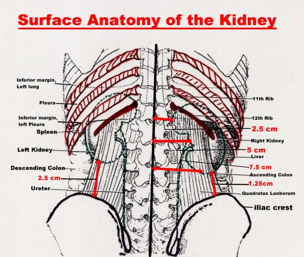 3 Surface Anatomy of the Kidney Fig.