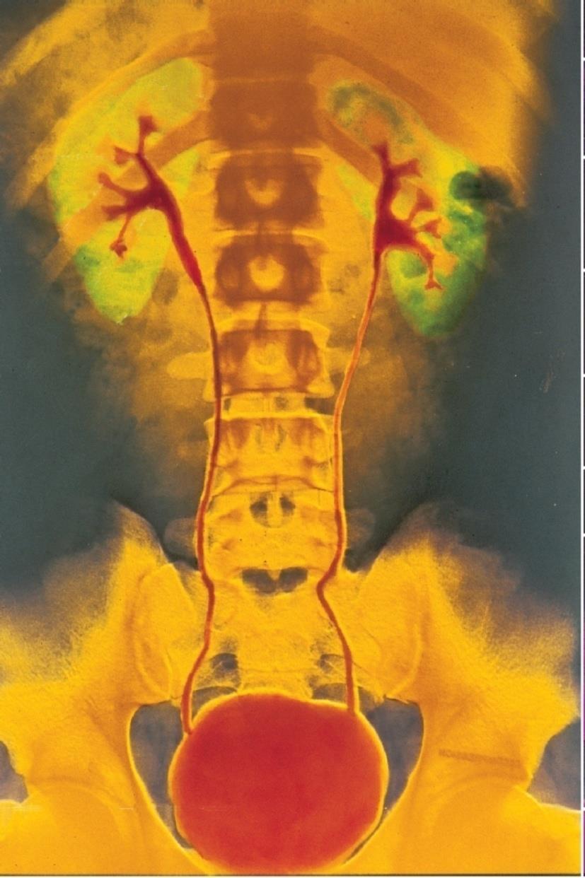 Radiograph of the urinary system Copyright The McGraw-Hill Companies, Inc.
