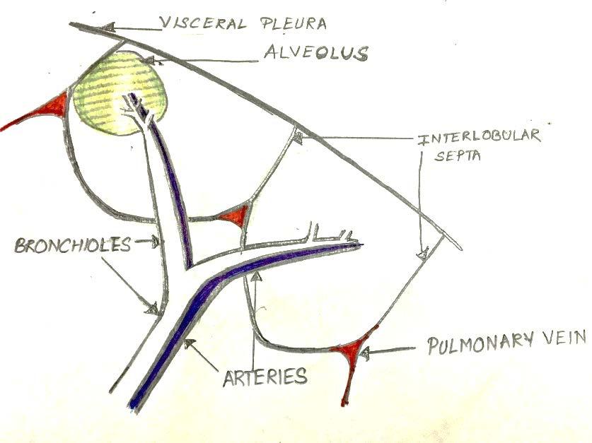 Tool 1 Decoding Alveolar and Interstitial anatomy Secondary pulmonary nodule (SPL) The lung