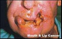 Smokeless tobacco Sniffed through the nose, held in the mouth, or chewed Effects last 3 times longer than that of a cigarette