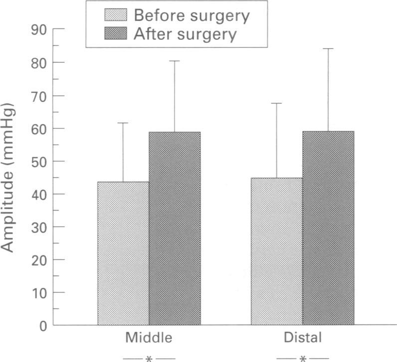 When the two fundoplication groups were separately analysed, an increase in amplitude was recorded only in patients operated on with a Nissen-Rossetti fundoplication, whereas relatively unchanged