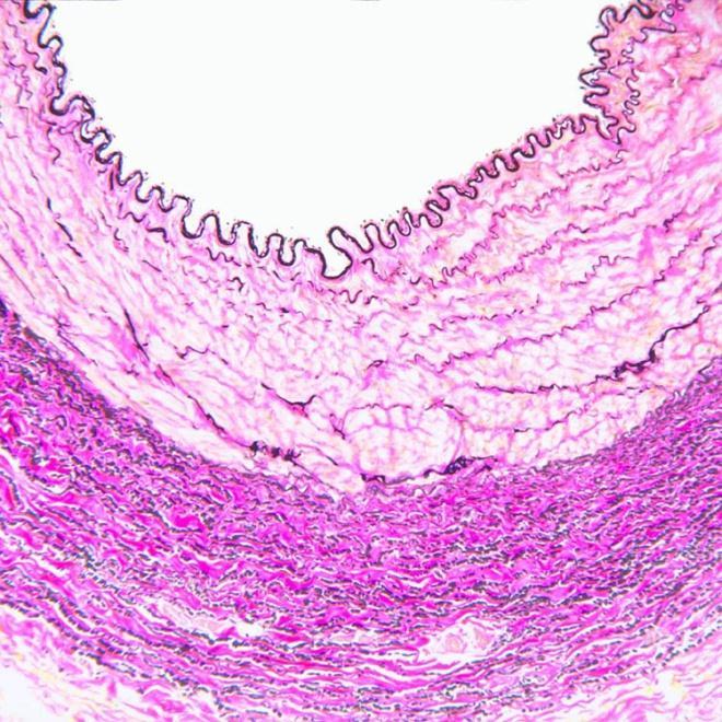 uniform structure Vascular structure is more complex with 3 layers