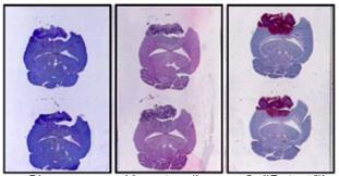 Rat Brain Glioblastoma in Frozen Sections Gross morphological detection of Rat