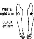 Limb Electrode Placement- Arms Place one electrode on the right arm and one electrode on the left arm Position