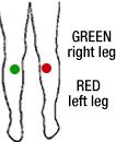 Limb Electrode Placement- Legs Place one electrode on the right leg and one electrode on the left leg Use
