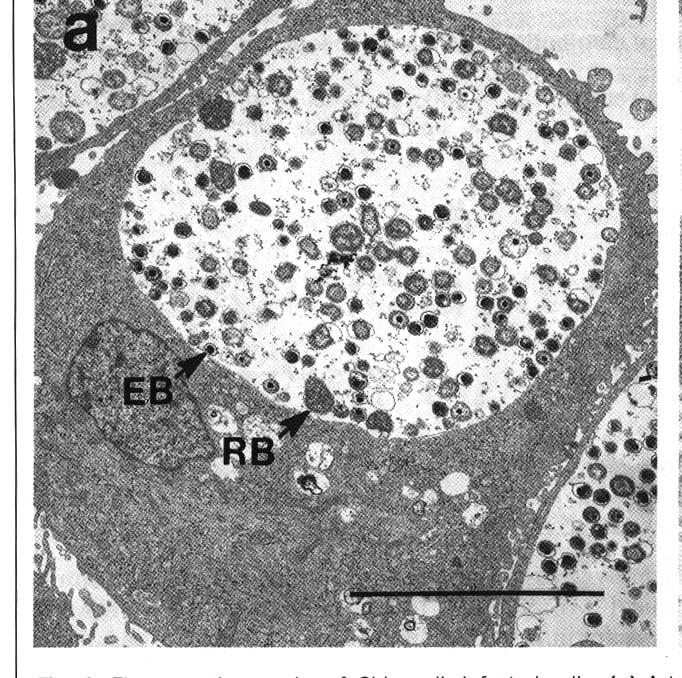 «Chlamydiae» Original bacteria Intracellular cycle