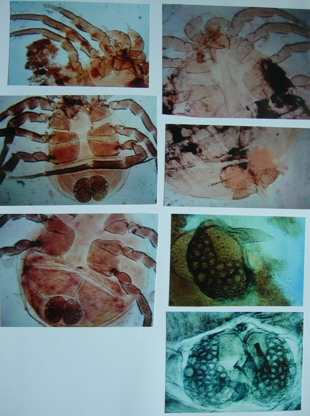 Plate 199: Top left: male anterior venter. Top right: female anterior venter. Middle left: male venter.