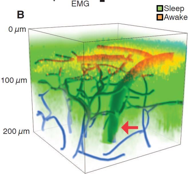 Sleep is a very active mechanism: - Brain consumes similar amounts of energy during wake and