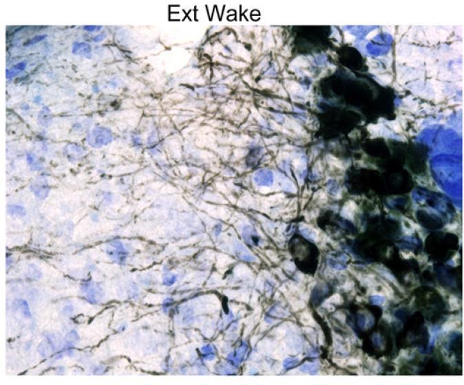 Connections between neurons are strengthened or weakened - Gain new insights Sleep Increases