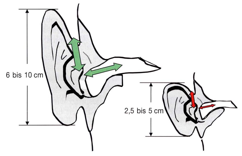 Why measure RECD? Anatomical terms Every ear canal has an individual shape and size!