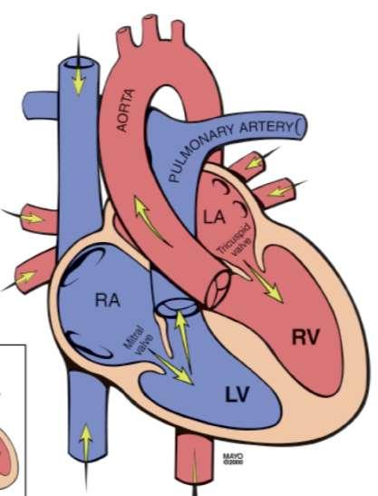 CONGENITALLY CORRECTED TGA RV is systemic ventricle Survival to adulthood Systemic