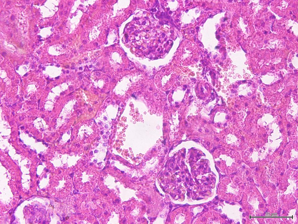 group with a magnification 4x (: Glomerolus, : Proximal