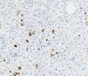 The majority of these cells are morphologically consistent with lymphocytes,