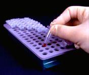 Test Tube Handling Tips Avoid resting arms on the sharp edges of the workstation or lab bench.