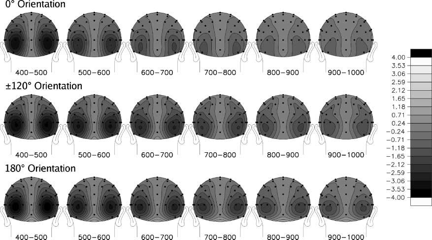 Figure 3. Time series of topographic voltage maps of the SPCN difference waves. The individual scalp maps represent the topography of the mean voltage of the SPCN in the indicated latency windows.
