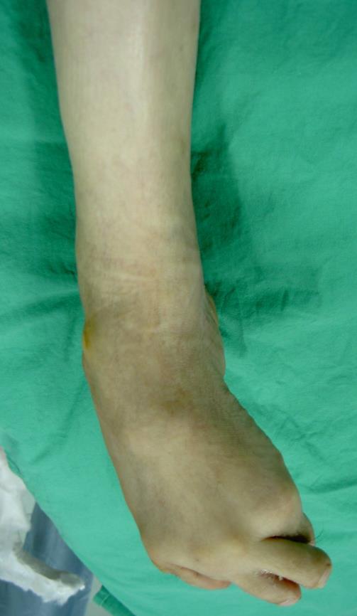 Case IV: A 44-Year-Old