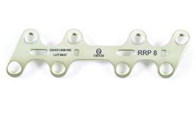 Plate Product Description Rearfoot Recon Plate 6 Hole Rearfoot Recon