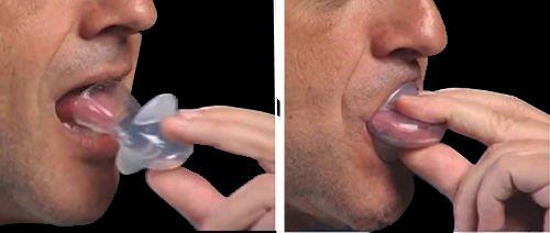 Tongue Retainer Soft silicone tongue retainer creates gentle suction around the tongue, which holds it in place to help prevent blocked airway