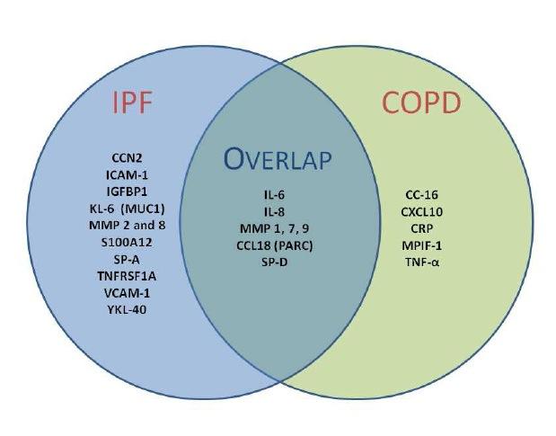 Recent biomarker development project for lung disease diagnosis COPD vs IPF NIH development project to construct biomarker sets to distinguish patients with chronic