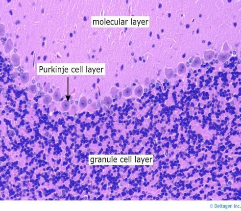 Purkinje cells compare