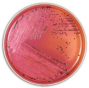 Case Definition Infection with Salmonella Newport PFGE pattern 61 Illness