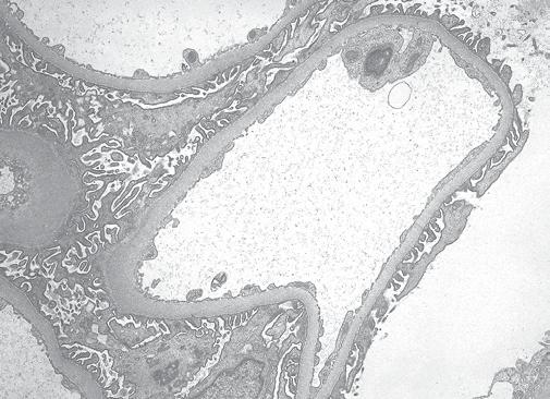 afferent arteriole mesangial cell Glomerulus efferent arteriole Bowman