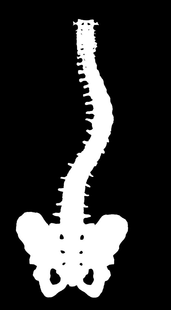 When scoliosis is present, the spine appears curved like a C or an S.