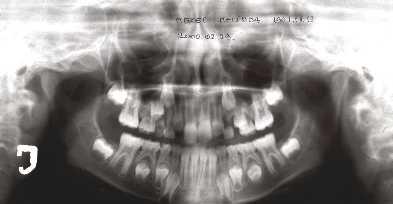 Numerical anomalies of teeth