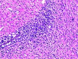 Figure 9 LN9-7d Tumor cell inoculation Treatment started LN9 5 5 LN9 tumors * Vehicle 67 nm BLZ95 67 nm BLZ95 6,7 nm BLZ95 Vehicle BLZ95 BLZ95 Vehicle Supplementary Figure 9.
