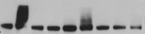 indicated (.5, and 5 minutes). This resulted in a progressive increase in CSF-R phosphorylation that was effectively inhibited by 67 nm BLZ95.