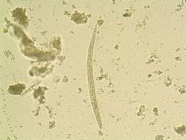 Diagnostic Characteristics Strongyloides stercoralis is an intestinal nematode with a very complex life cycle.