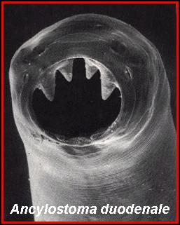 Scanning electron micrograph of the oral opening of Ancylostoma duodenale, another