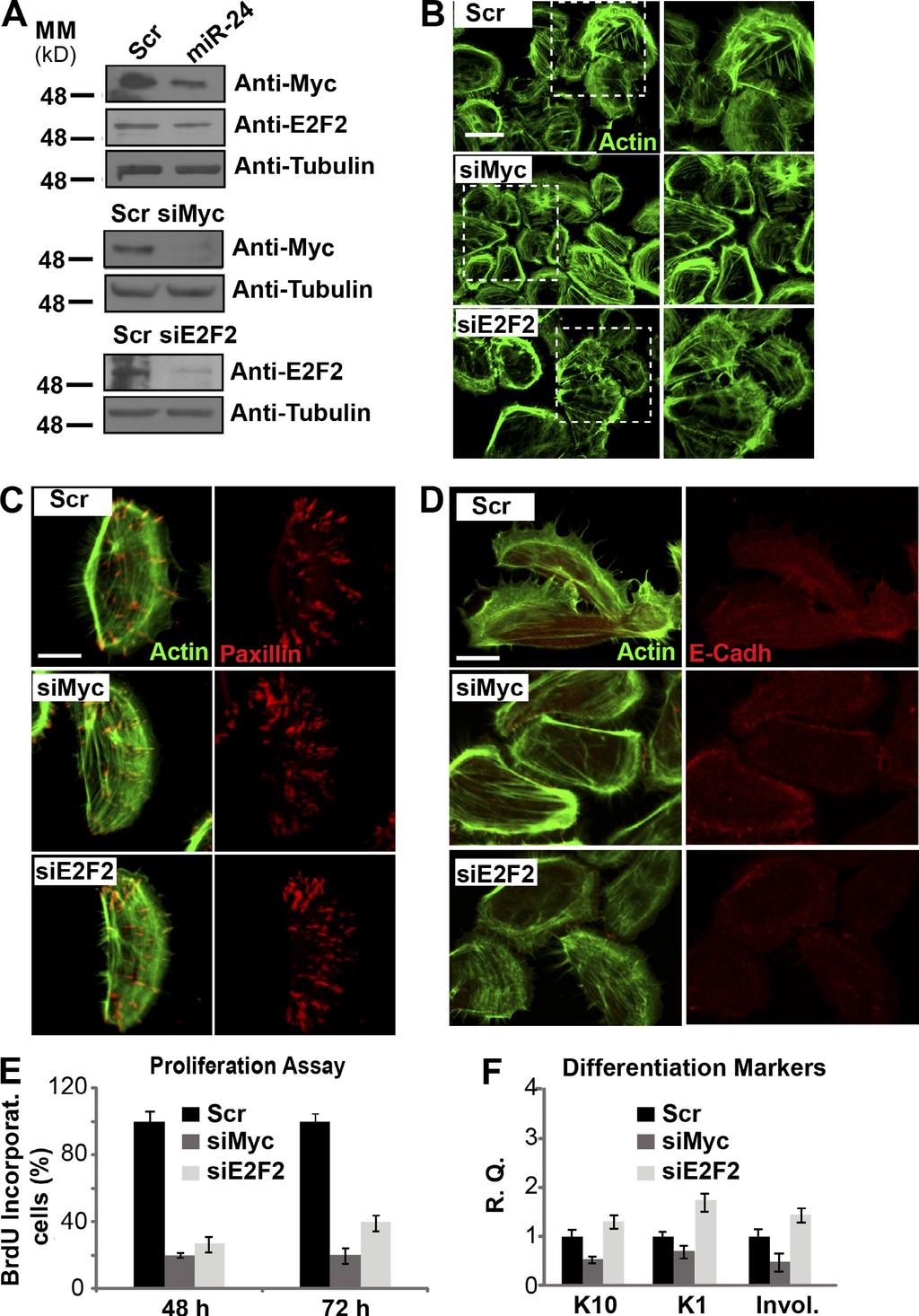 Figure S5. Silencing of Myc and E2F2 does not affect actin cytoskeleton.