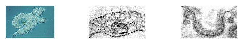Endocytosis: hagocytosis inocytosis Receptor-mediated endocytosis