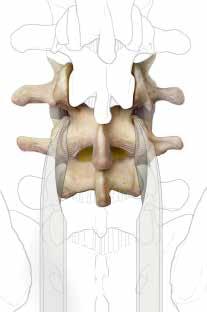 In particular, the MySpine MC guides are designed to support the surgeon with the option of a midline approach, in combination with the cortical bone screw trajectory, in order to achieve more