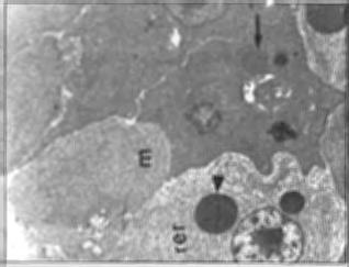 Fig. 3. Semithin section of control mesenteric pancreas showing normal cytoplasmic granularity ( Toluidene blue X800). Fig. 4.