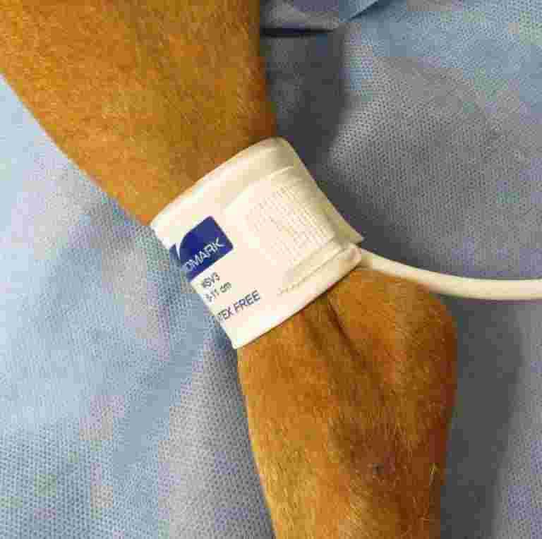 pulse oximeter, their blood pressure, the amount of carbon dioxide