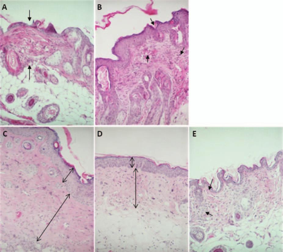 4 S.-H. Ryu et al. Fig. 3. Histopathological evaluation of mouse skin samples. Skin samples were stained with H&E staining and photographed at 200 magnification.