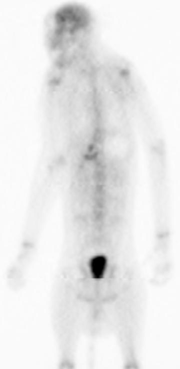 Appendix B Whole-body images demonstrating biodistribution of [ 18 F]SP203