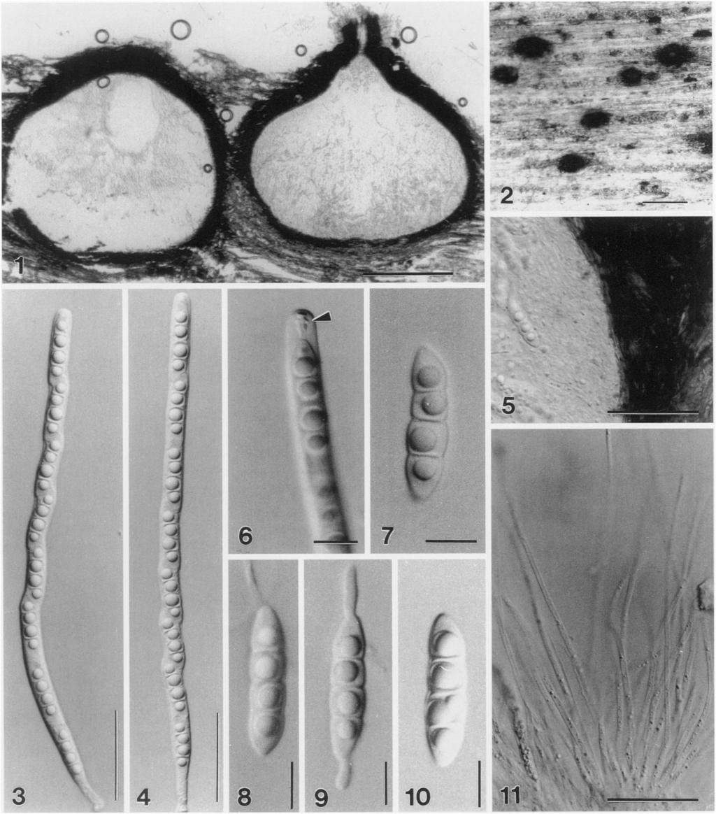 ~GS. 1-11. Interference micrographs of SaccardoeUa aquatzca (from holotype) 1. Section of the ascomata. 2. Appearance of ascomata on submerged wood. 3, 4. Asci. 5. Section of the peridium. 6.
