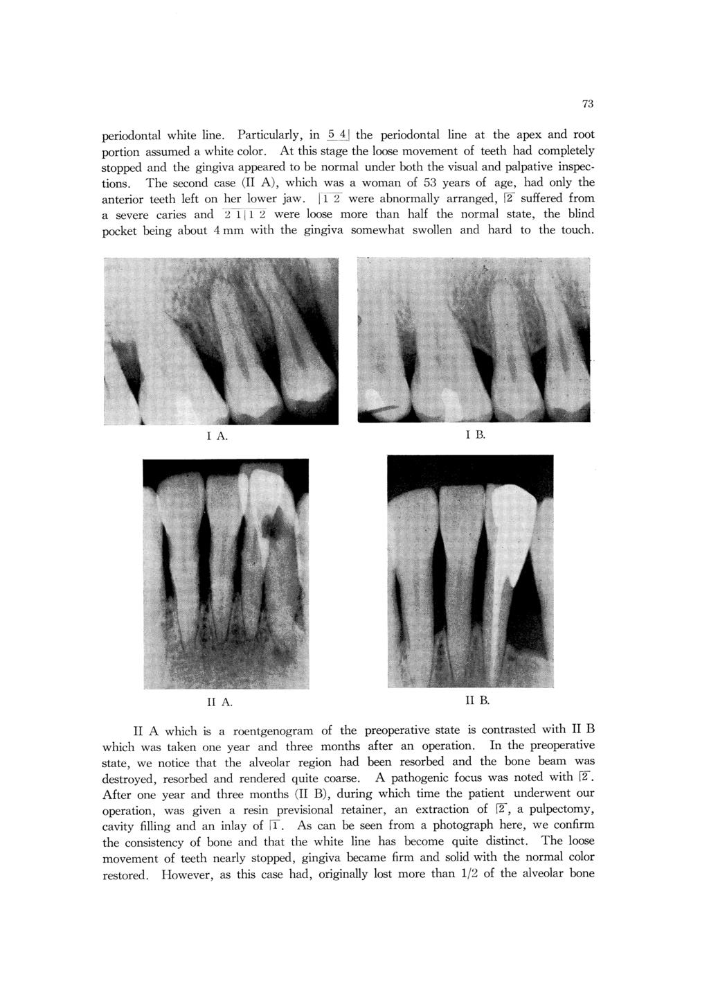 periodontal white line. Particularly, in 5 4 the periodontal line at the apex and root portion assumed a white color.
