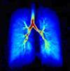 Protecting Non-Injured Lungs: The