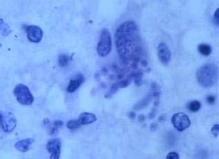 (A). Toxoplasma gondii in