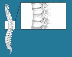 LIFTING The spine is a remarkable structure combining strength, protection and flexibility. This complex array of bones and joints however, is not without its limits.