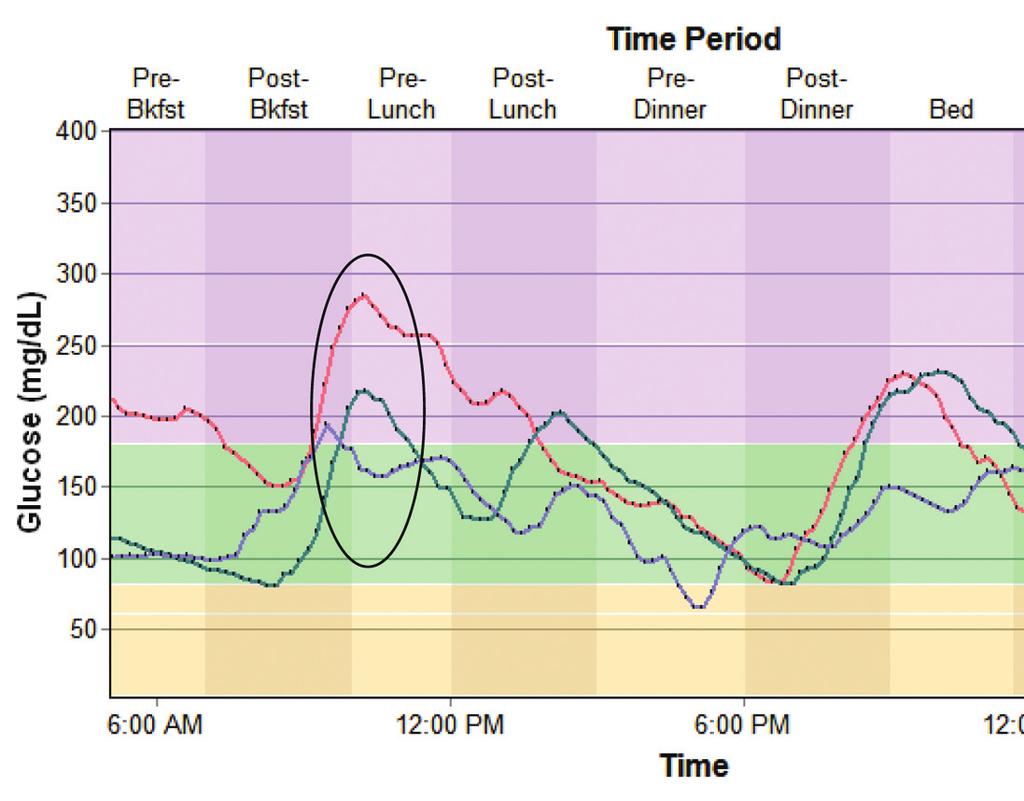Feature Article / Early Experiences with CGM Figure 2. Glucose Modal Day report.