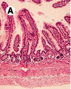 PATHOGENESIS OF VIRAL DIARRHEAS Replicate within the villous epithelium, causing patchy