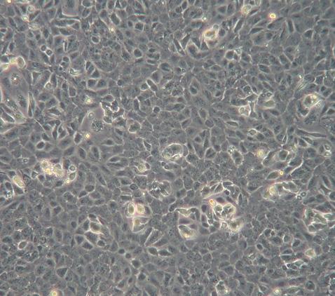 LMO2 Scl -Actin e T 0 + 1 dy T 0 + 2 dys Hemtopoietic colonies per 30 000 cells f 250 200