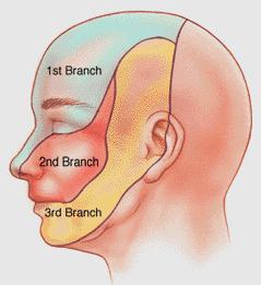 Facial Pain How can we manage it.